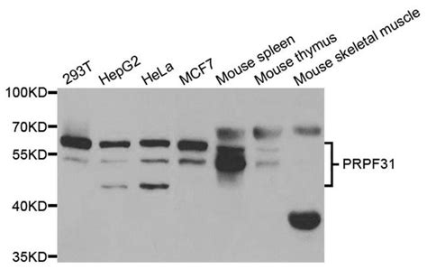 Prpf31 Polyclonal Antibody Pa5 76808