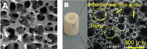 A Sem Image Showing Interconnected Porous Structure Of Human