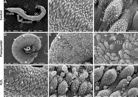 Scanning Electron Microscopy Of The Teguments Of Adult S Mansoni