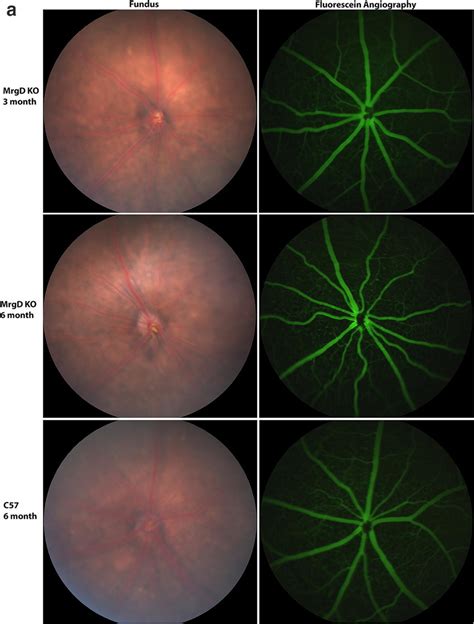 Retinal Vasculature Evaluation Of Mrgd−− Mice By Fundus Fluorescein