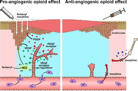 Figure 2 From Opioids Modulators Of Angiogenesis In Wound Healing And