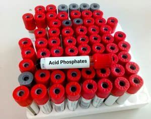 Acid Phosphatase – Diagnostic Plus