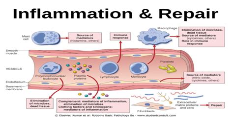 Inflammation And Repair Chronic Inflammation Cell Types In Chronic