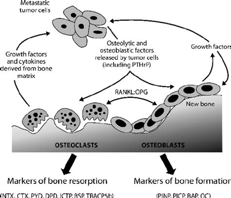 The Vicious Cycle Of Bone Metastases Reproduced And Adapted From Guise