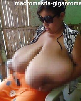 Macromastia Porn Pictures Xxx Photos Sex Images Pictoa
