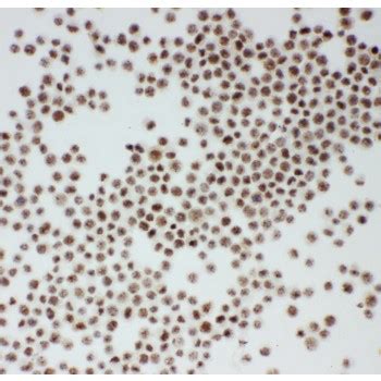 Arid A Antibody Novatein Biosciences