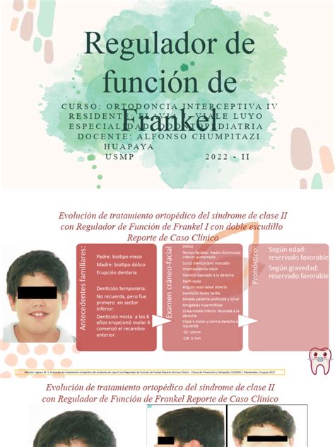 Regulador De Frankel Pdf Cirugía Ortopédica Ortodoncia