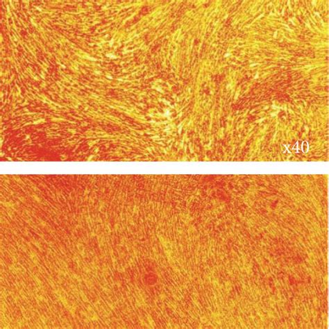 Identification Of Pdlscs And Establishment Of Inflammatory