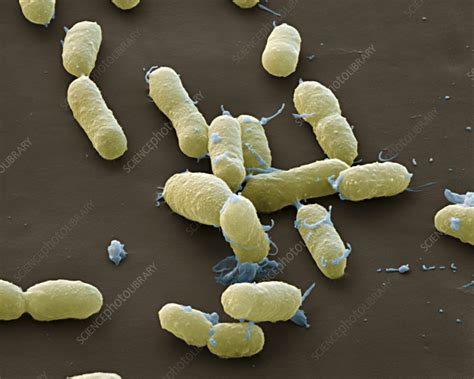 Plague Bacteria Yersinia Pestis SEM Stock Image C009 0893