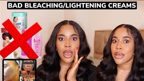 Worst Lightening And Bleaching Creams In The African Cosmetic