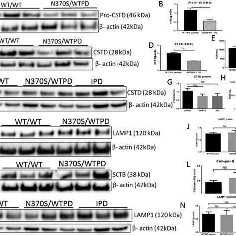 Pro Cathepsin D CSTD 46kD A And B Mature Cathepsin D CSTD 28kD