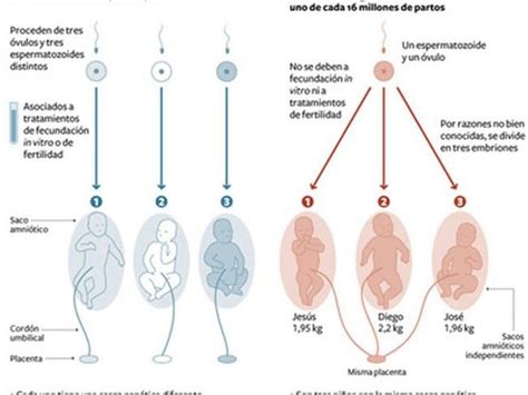 Cómo se forman los trillizos MiBBmemima