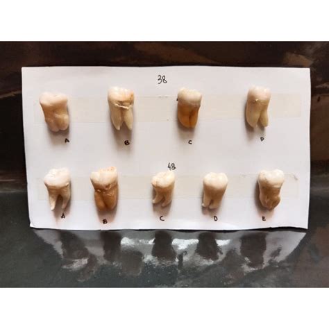 Jual Gigi Molar Rahang Bawah M Mirip M Shopee Indonesia