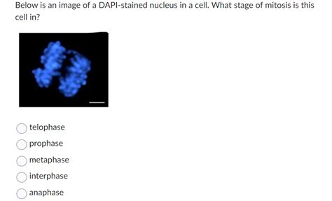 Solved Below Is An Image Of A Dapi Stained Nucleus In A Chegg