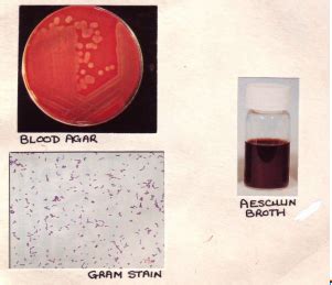 Listeria And Erysipelothrix Flashcards Quizlet