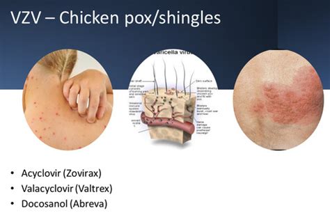 Antiviral Drugs Flashcards Quizlet