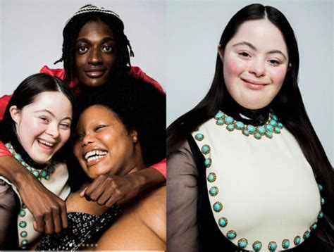 Prima Modella Gucci Con Sindrome Di Down Chi Ellie Goldstein