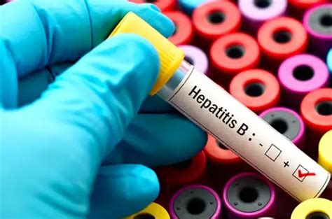 Pelaksanaan Program Pencegahan Penularan Hepatitis B Dari Ibu Ke Anak