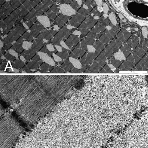 —photomicrograph Of Section Of Canine Semimembranosus Muscle Containing