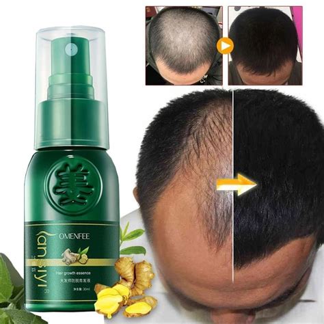 Cheap Ginger Hair Growth Spray Serum Anti Hair Loss Products Fast Grow