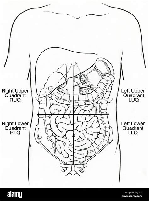 Diagrama De órganos De Cuadrantes Abdominales