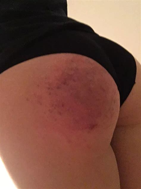 When She Sends Me Pictures At Work The Day After Nudes Spanking NUDE PICS ORG