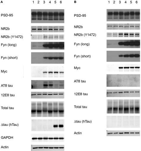 Western Blot Of Total Brain Extract And Synaptosomal Fractions We