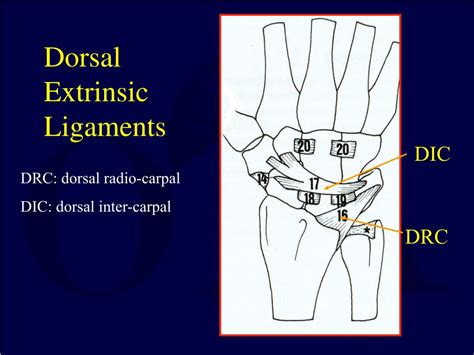 PPT Carpal Fractures And Dislocations PowerPoint Presentation Free