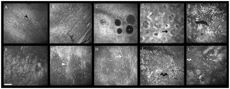 Pharmaceuticals Free Full Text Confocal Microscopy And Anterior