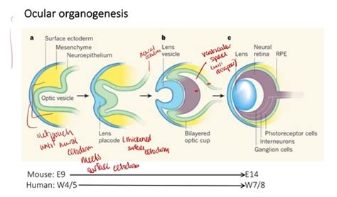 Ocular Embryology Flashcards | Quizlet