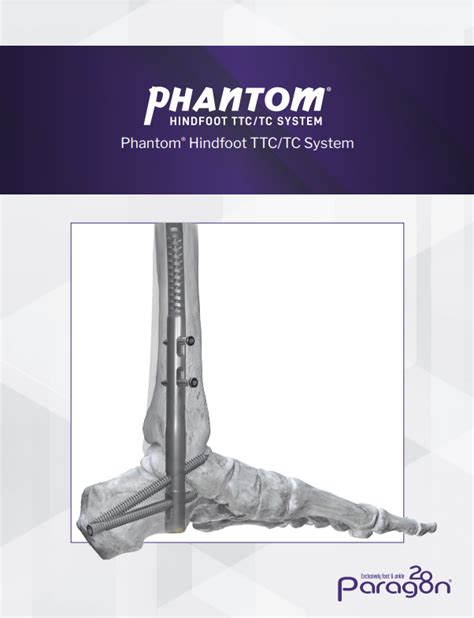 Phantom Hindfoot TTC TC System Paragon 28