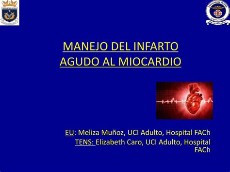 Pdf Manejo Del Infarto Agudo Al Miocardioenfermeria Medicina Intensiva Cl Tens Manejo Del