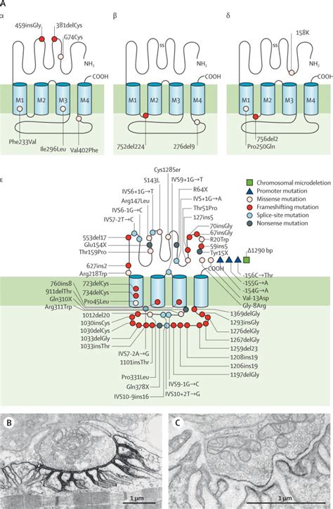 Congenital Myasthenic Syndromes Pathogenesis Diagnosis And Treatment