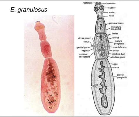 Echinococcus granulosus | Medical laboratory science, Clinical ...