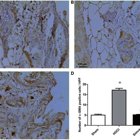 Immunostaining For A Sma Arrows Show Myofibroblast Cells In Cutaneous