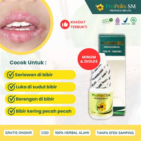 Jual Obat Luka Di Sudut Bibir Kering Pecah Pecah Sariawan Berengan