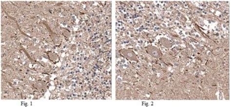 Anti Precerebellin Antibody From Rabbit Purified By Affinity