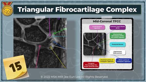 Kor Anatomy15 Triangular Fibrocartilage Complex Tfcc Wrist Mri