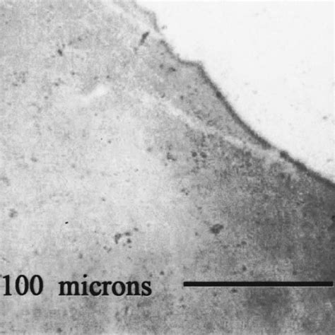 Micrograph Of Aln Film Grown On Bulk Mercury Cadmium Telluride After