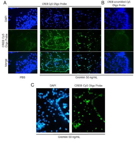 Figure From In Situ Dna Protein Interaction Assay To Visualize