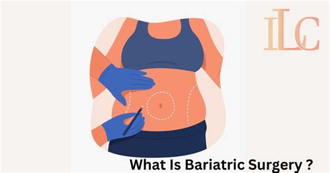 Pre Operative Care Of Bariatric Surgery Dr Achal Agrawal Ilc Indore Laparoscopic Center