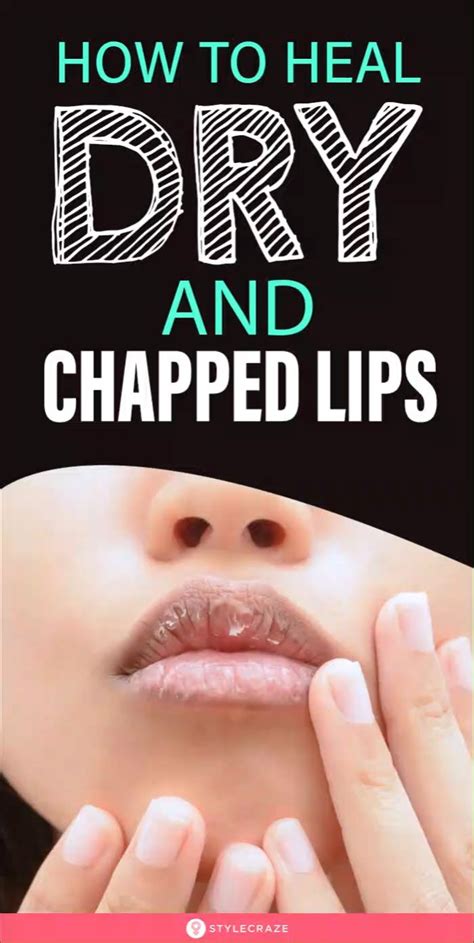 If You Have Dry And Chapped Lips This Is How You Heal Them Video