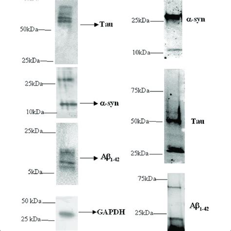 Presence Of α Syn Aβ Tau And Their Heterocomplexes In Platelets Download Scientific