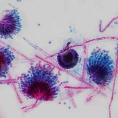 Frontiers in Plant Science | Plant Pathogen Interactions 