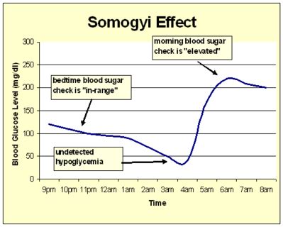 Undiagnosed diabetes symptoms weight loss, somogyi effect dawn ...