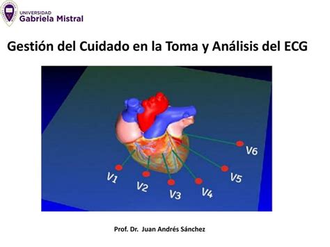 Gc En La Toma Y An Lisis De Ecg Dr Juan Andr S S Nchez Eu Mgp Mge Udocz