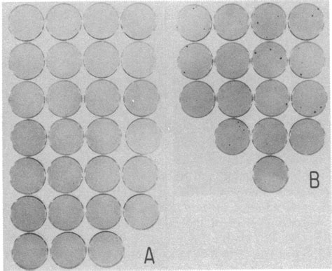 Transformation Of Balb3t3 Cells With Dna From The Meth A Sarcoma