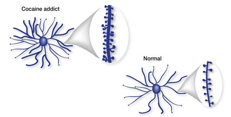 Drug Use Changes The Brain Over Time