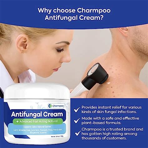 Over The Counter Antifungal Cream For Tinea Versicolor At Donald Mccann