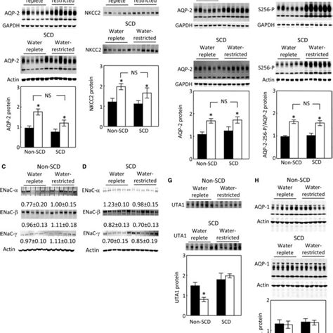 Water Restriction Significantly Increases Protein Abundance Of AQP2 And